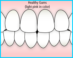 healthy gums